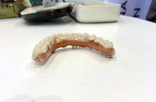 denture