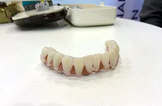 dental dentures