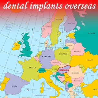 Best place to get dental implants